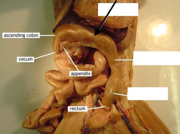 <p>What portion of the large intestine is indicated by the black arrow?</p>