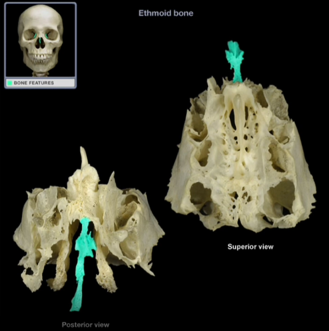 <p>Perpendicular Plate</p>