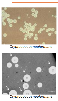 <ul><li><p>Caused by Cryptococcus species (i.e., neoformans, gattii)</p></li><li><p>Found in <strong>soil, pigeon droppings </strong>(<strong><u>yeasts </u></strong>are inhaled)</p></li><li><p><strong>Thick polysaccharide capsule </strong>(reduces phagocytosis)</p></li><li><p>Cryptococcus <strong>can persist within phagocytes</strong></p></li><li><p>Diverse morphologies: titan cells- big  (arrows) – but <strong>no hyphae</strong></p></li><li><p>Infects the lungs and central nervous system (brain/spinal cord)</p></li></ul><p></p>