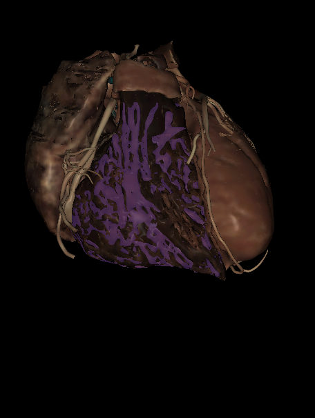 <p>Name the structure highlighted </p>