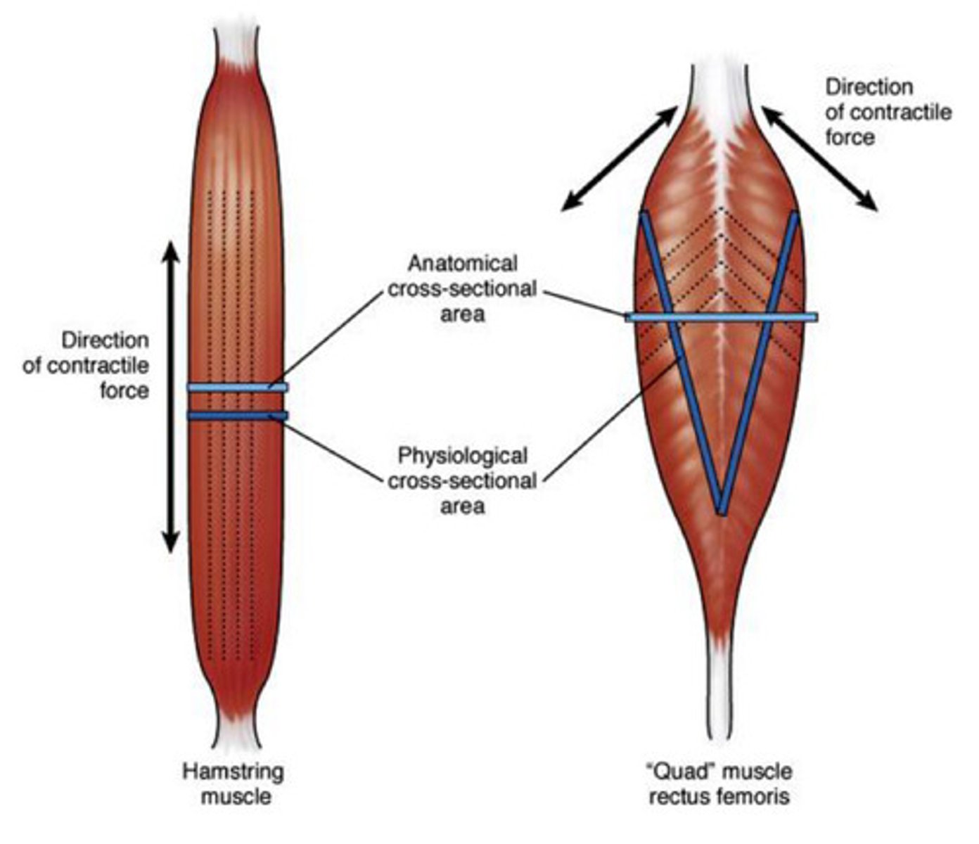 <p>pennate muscle: muscle fibers have an oblique line of pull</p><p>-angle of pennation allows muscle to have more contractile units per CSA</p><p>-more pennation= greater force of contraction due to more sarcomeres per CSA</p>