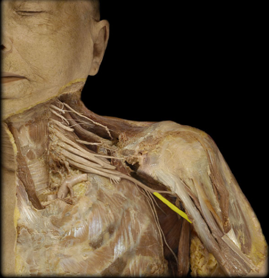 name this plexus and nerve