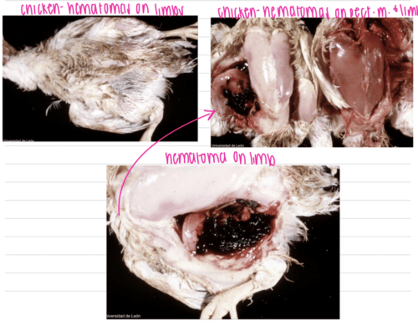 <p>when there are so many hemorrhagic cells that they create an elevation. caused by trauma or coagulopathy</p>