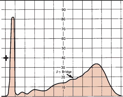 <p>Cirrhosis</p>