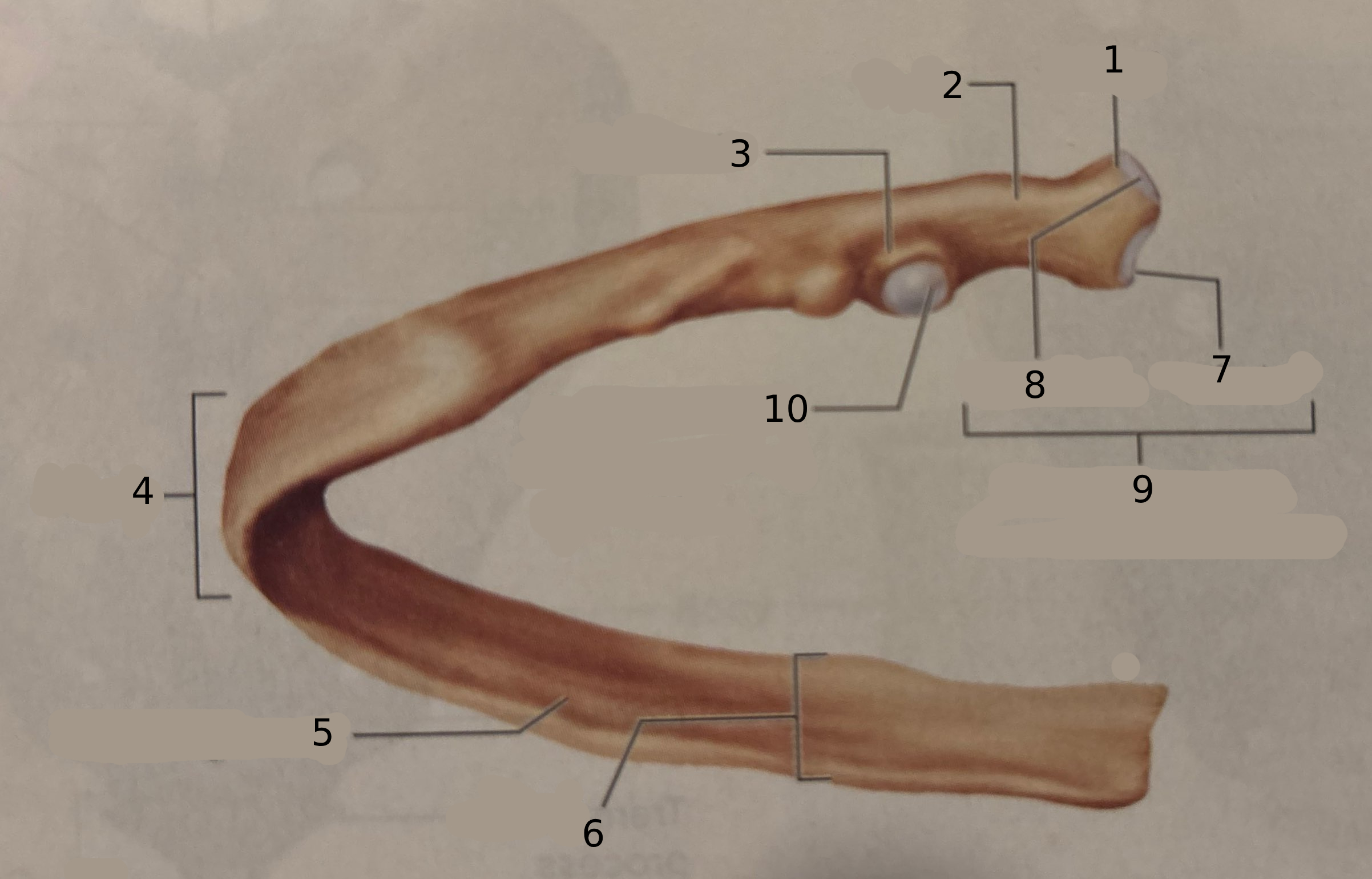 <p>#6</p>