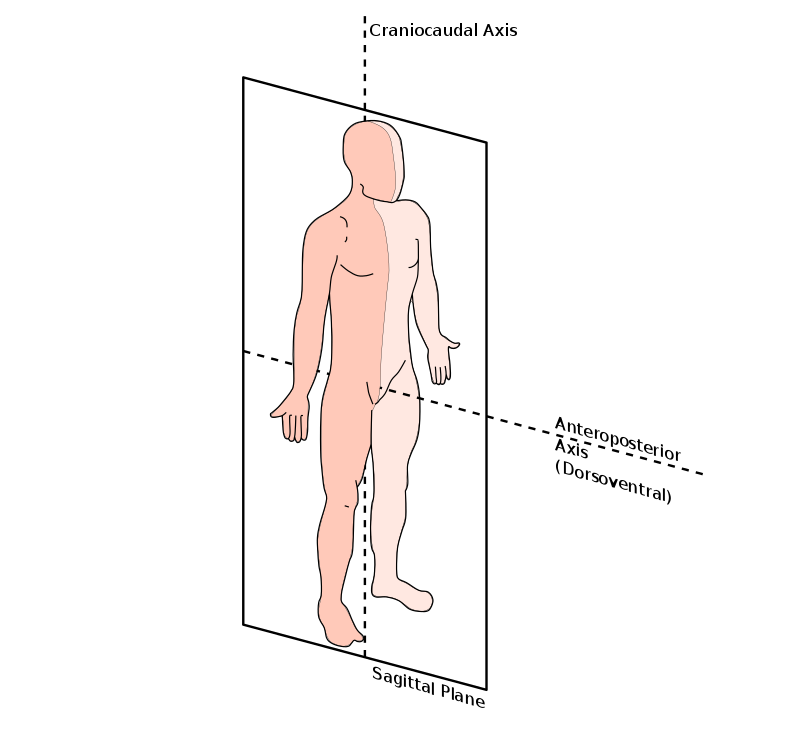 <p>Refers to a lengthwise plane that divides the body into left and right portions. Midsagittal is used only when referring to the entire body</p>