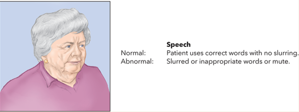 <ul><li><p>Ask the patient to say, “You can’t teach an old dog new tricks.” An uninjured person’s speech is usually clear.</p><ul><li><p>A stroke patient is more likely to show an abnormal response to the test, such as slurred speech, the wrong words, or no speech at all.</p></li></ul></li></ul><p></p>
