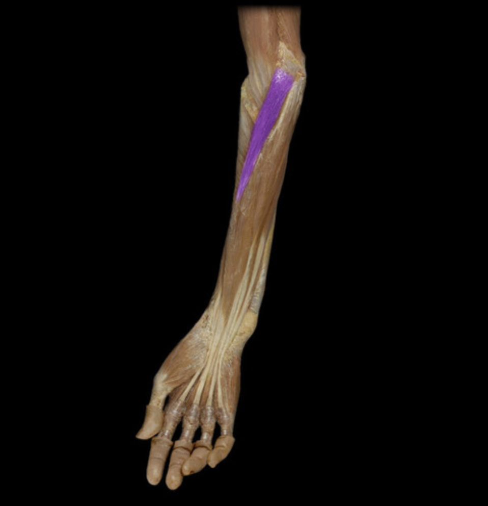 <p><em>table 1, median n (C6-C7), deep to superficial flexors</em><br><em>O: medial epicondyle of humerus</em></p>