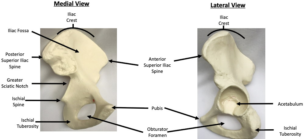 <p>What bone is this?</p>