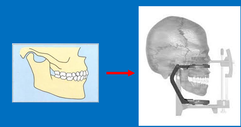 <ul><li><p>Choose an occlusal relationship that is reproducible in the patient so that it is kept the same throughout all stages of making a denture</p></li></ul><p></p>