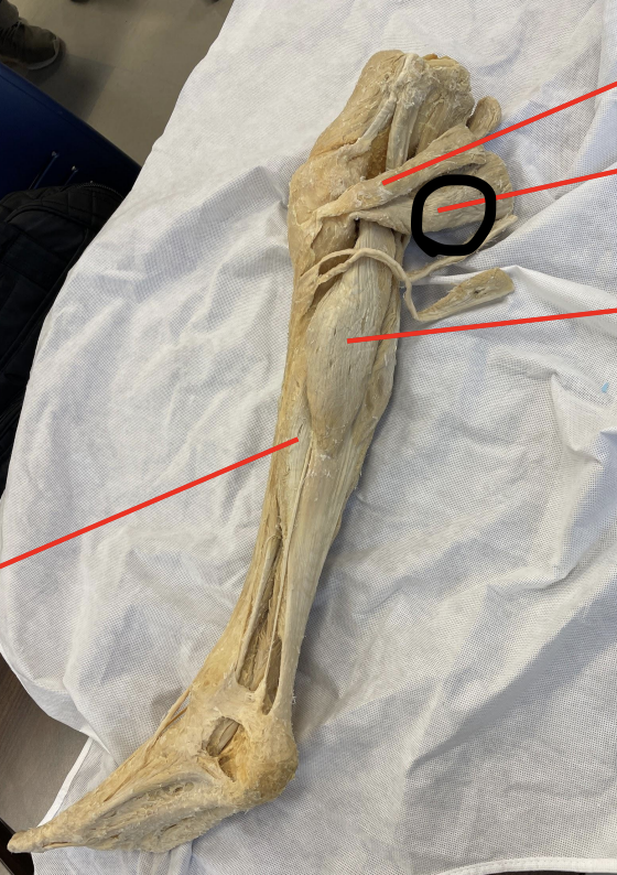 <p>identify + state origin, insertion, action, innervation of marked structure</p>