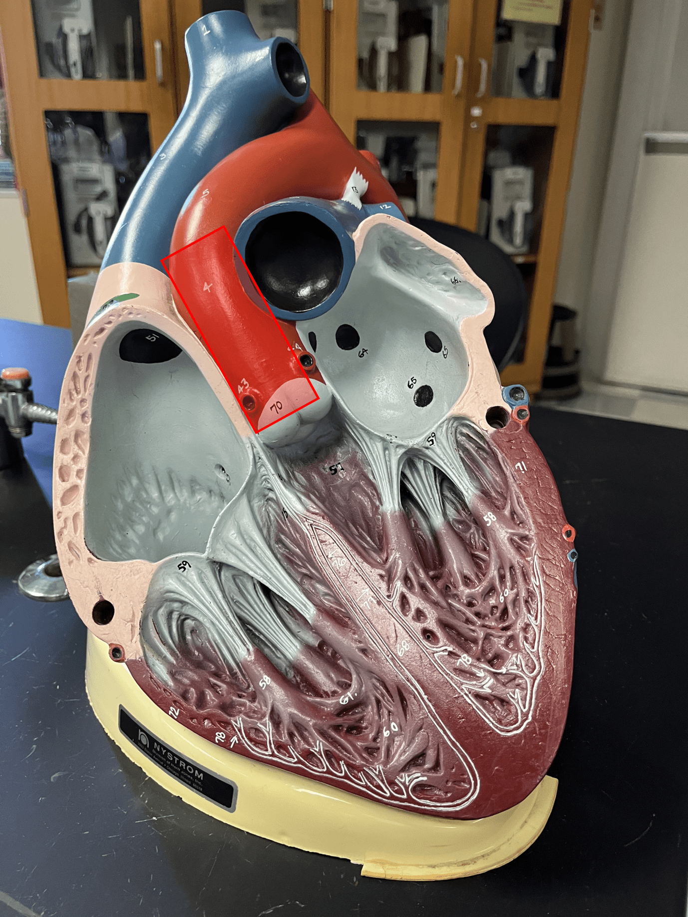 • The part of the aorta arising from the base of the heart.

• Continues on as the aortic arch.