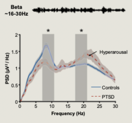 <ul><li><p>during sleep, cortical hyperarousal indexed as increased power in high frequencies (beta and gamma bands)</p></li><li><p>Denis et al (2023): increased levels of cortical hyperarousal during sleep in PTSD patients</p></li><li><p>hyperarousal suring sleep interacts with other domains of hyperarousal experienced during the day</p></li></ul><p></p>
