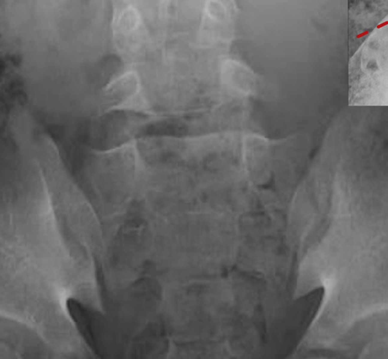 <p>What projection view is this?</p>