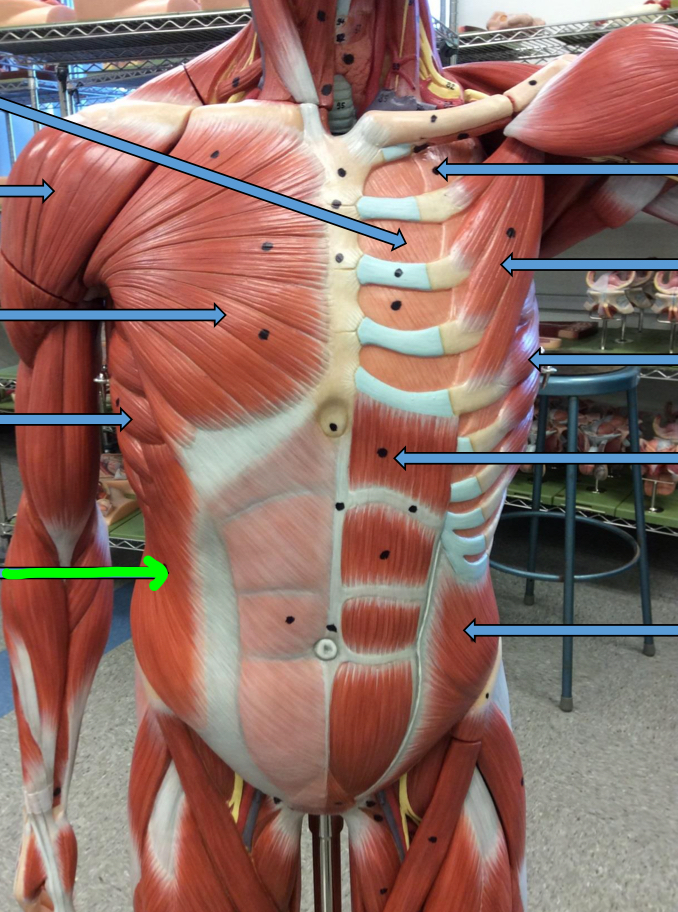 <p>Identify this muscle?</p>