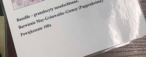 <p>rekacje alregiczne, zapalenie, przeciwnowotworowy, regeneracja, nie fagocytują, tylko uwalniają substancje z ziarnistości</p>