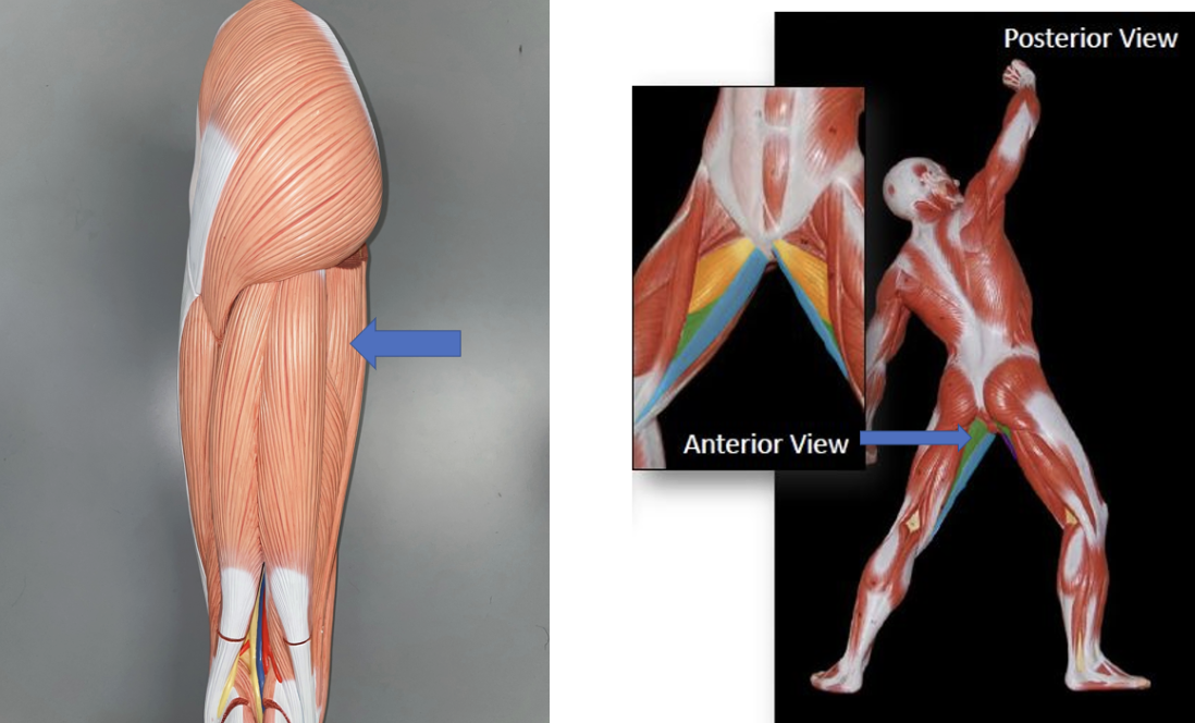 <p>muscle name &amp; action</p>