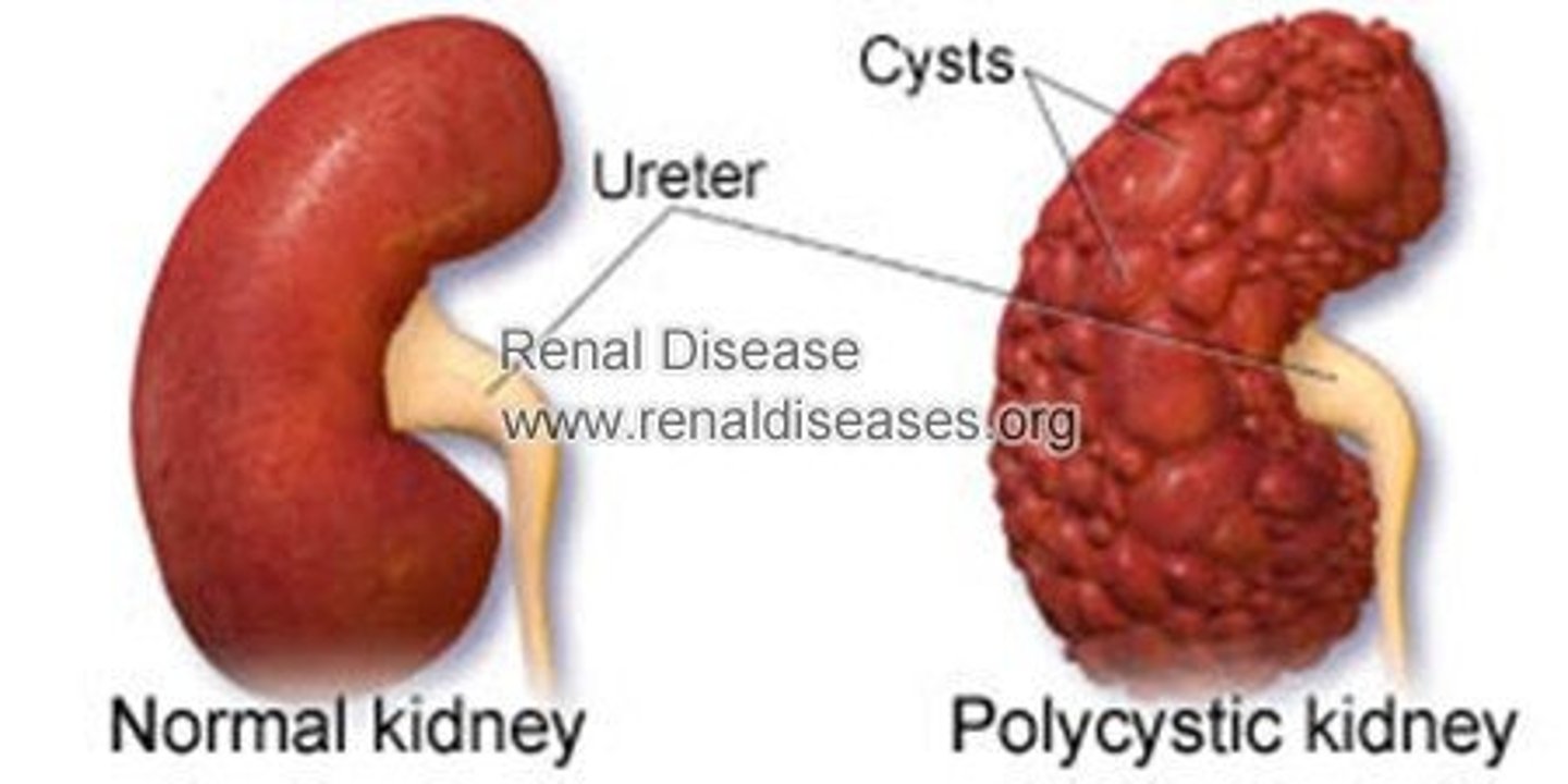 <p>c. Discussion of options for genetic counseling</p><p>Because a 28-year-old patient may be considering having children, the nurse should include information about genetic counseling when teaching the patient. The well-managed patient will not need to choose between hemodialysis and peritoneal dialysis or know about the effects of transplantation for many years. There is no indication that the patient has chronic pain.</p>