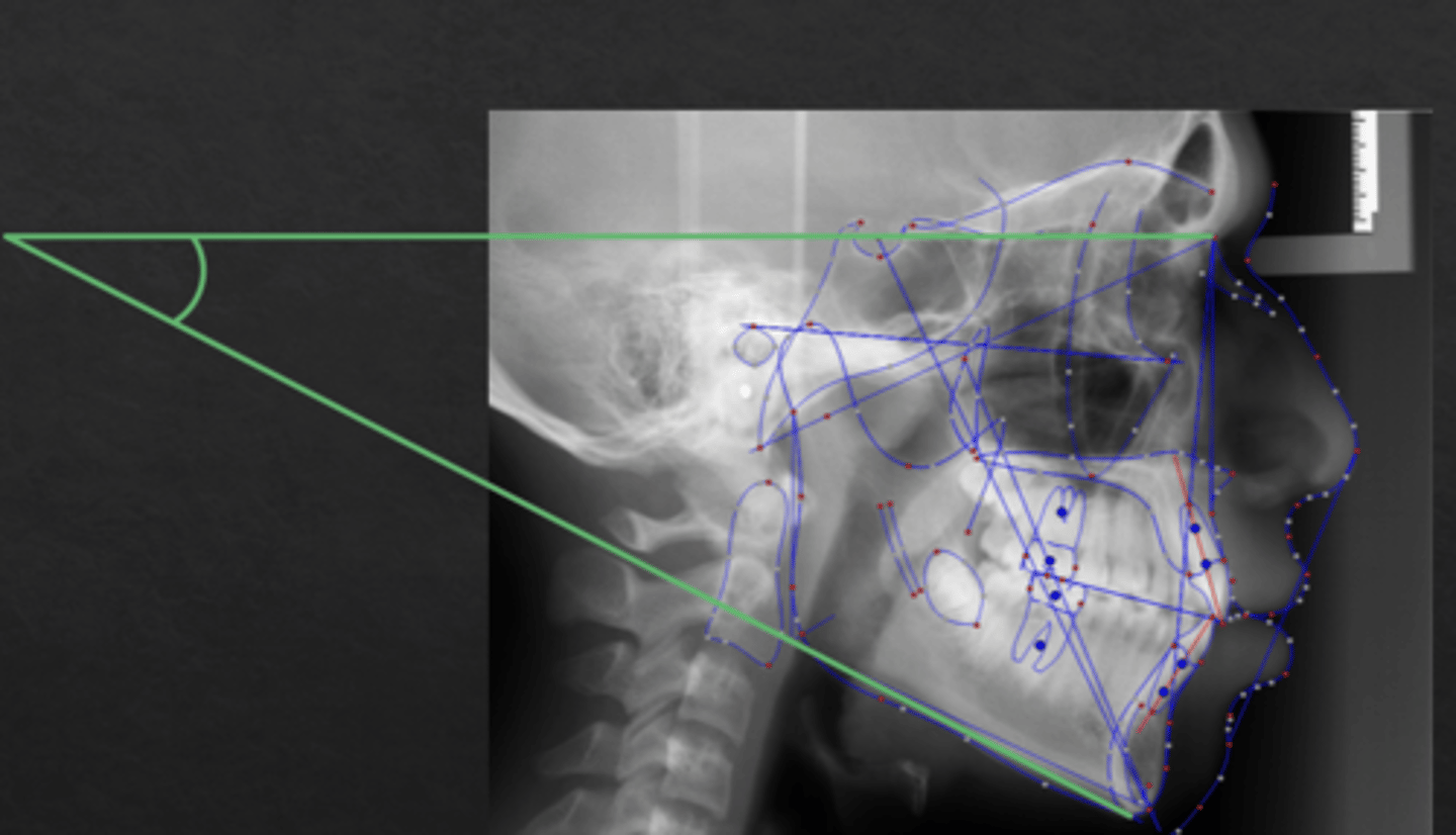 <p>What reference line is this?</p>