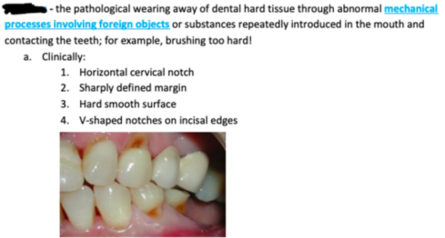 <p>The pathological wearing away of dental hard tissue through abnormal mechanical processes involving foreign objects or substances repeatedly introduced in the mouth and contacting the teeth; for example, brushing too hard!</p><p>Clinically:</p><p>Horizontal cervical notch</p><p>Sharply defined margin</p><p>Hard smooth surface</p><p>V-shaped notches on incisal edges</p>