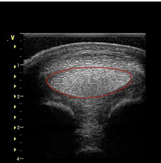 <p>what is the red circling?</p>
