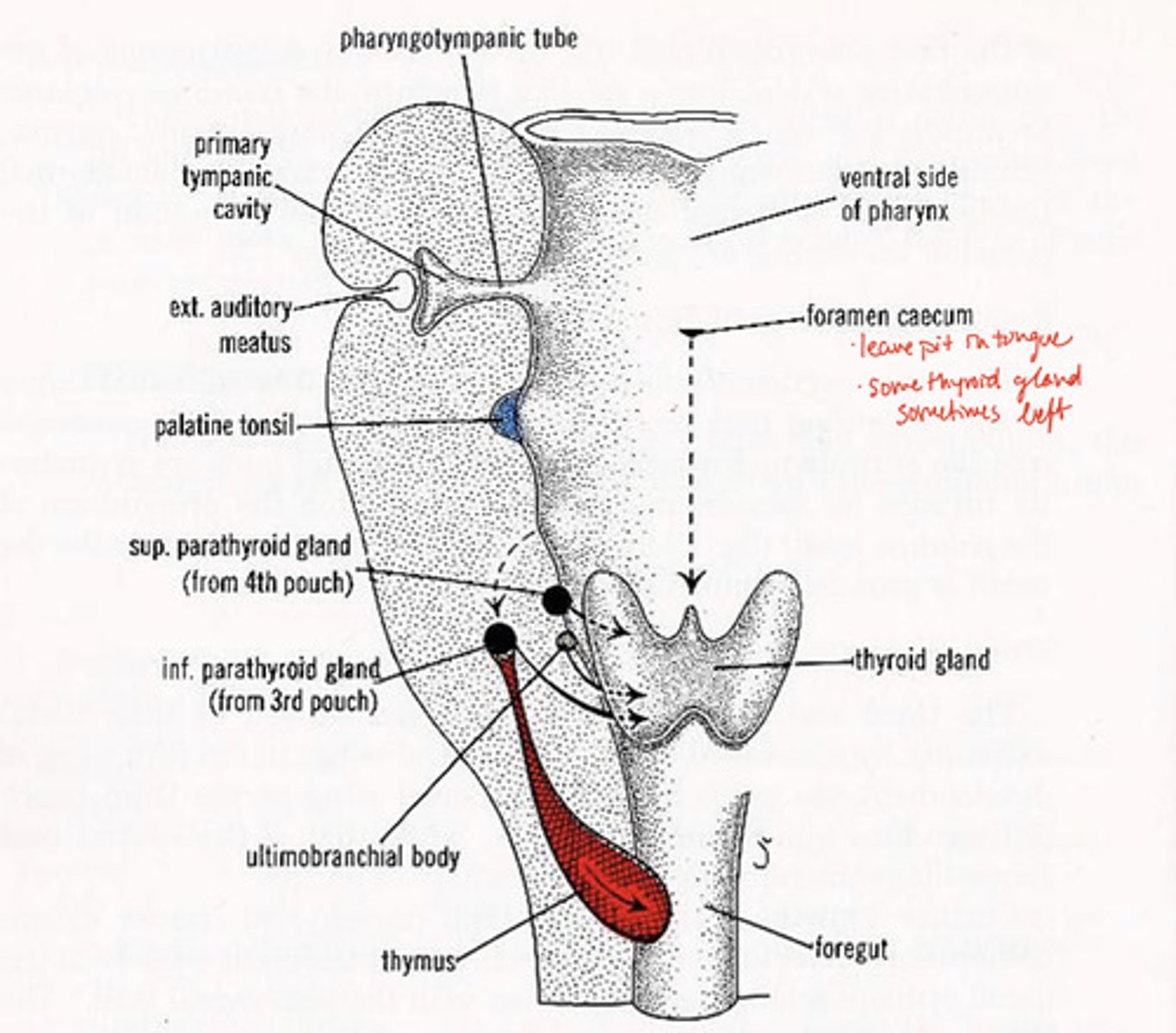 <p>leaves pit in tongue, some thyroid gland sometimes left</p>