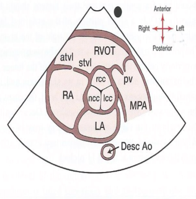 The Mercedes Benz logo of the Aortic valve!