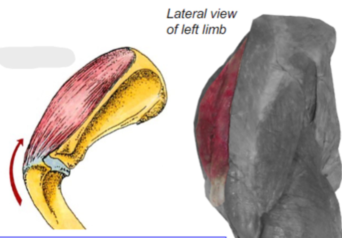 <p>Origin of supraspinatus muscle:</p>