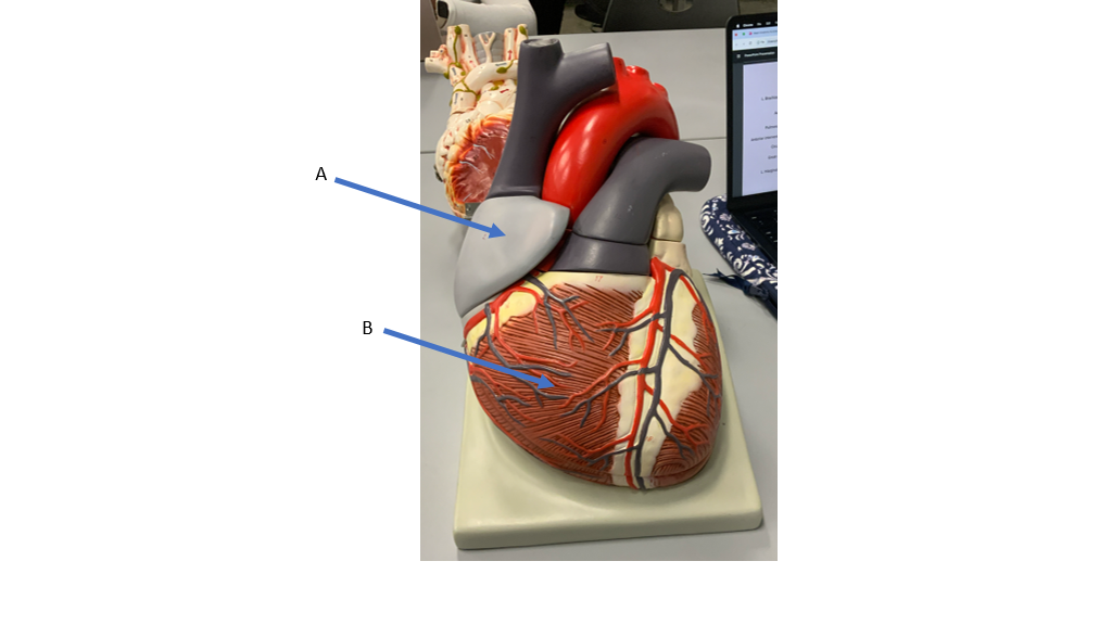 <p>what is A </p>