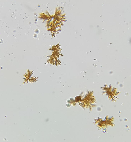 <p>What are these?</p><p>When are they normal &amp; are they in alkaline or acidic urine?</p><p>How might these negatively affect results of chemstrips?</p>