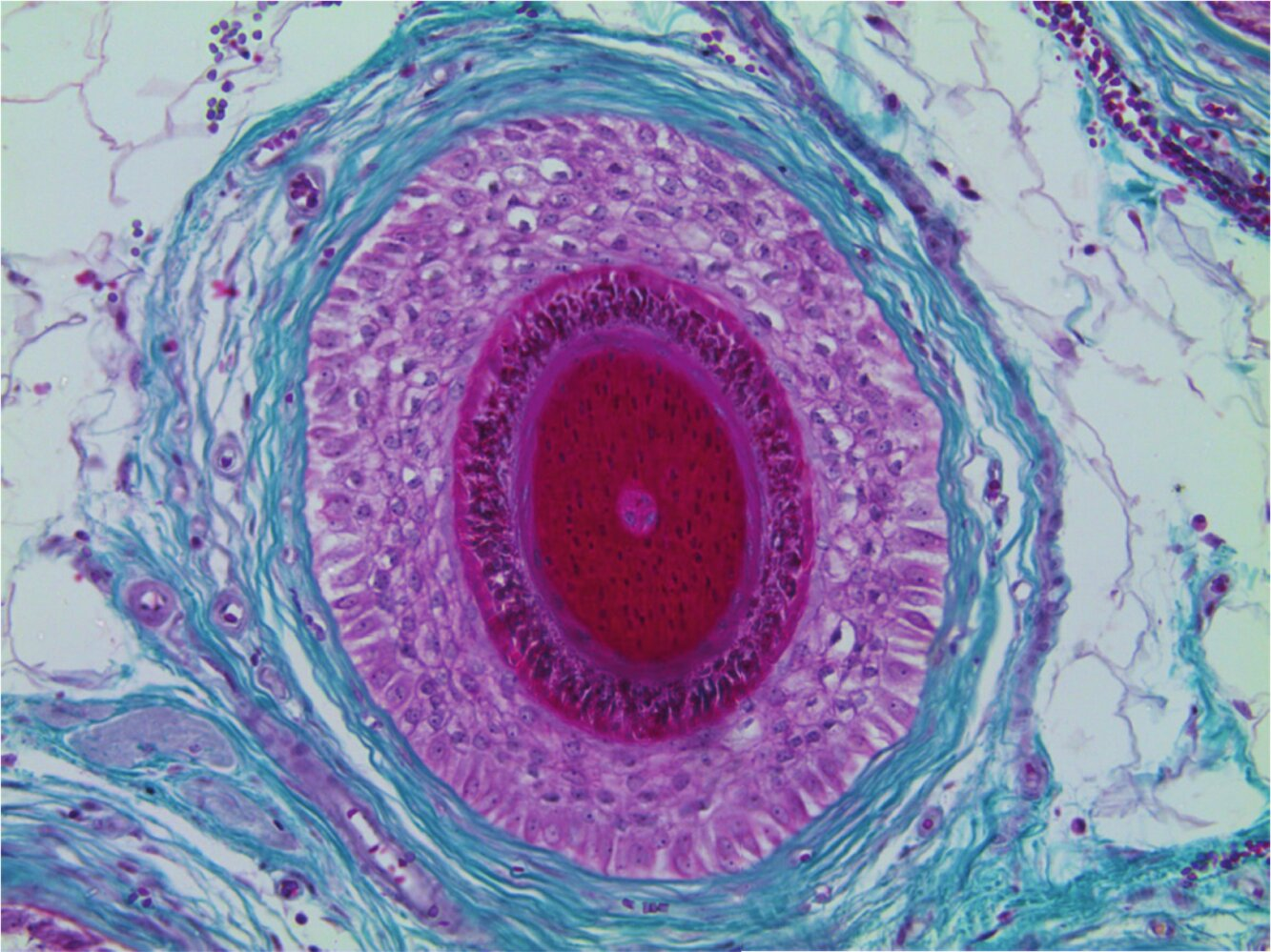 <p>16. Which statement most likely applies to the structure shown in the image?</p><p>A. It carries sweat gland secretions.</p><p>B. It develops from a primordial follicle.</p><p>C. It is a typical component of thin (hairy) skin.</p><p>D. It plays a key role in the skin's elasticity.</p><p>E. It is moved by striated skeletal muscle.</p>