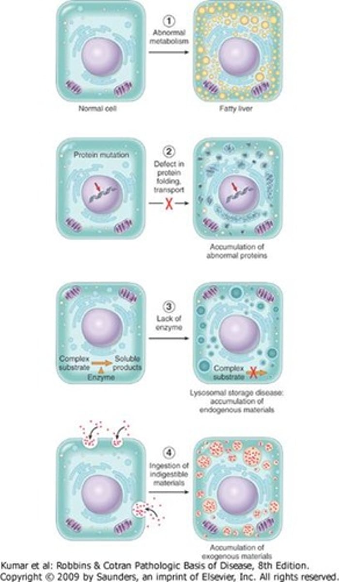 <p>- A normal substance accumulates at an increased rate (abnormal metabolism) e.g., fatty liver</p><p>- A normal substance accumulates due to lack of enzymatic breakdown e.g., lysosomal storage disease (LSD)</p><p>- Inability to breakdown phagocytized particles</p><p>- Defect in protein folding, transport</p>