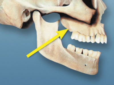 <p>what is this, its description and its appearance on images</p>