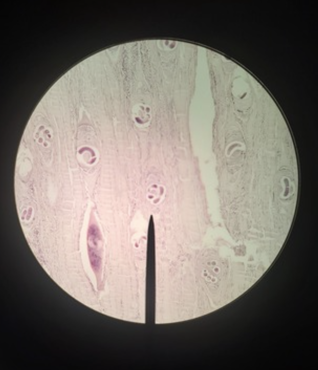 <ul><li><p>identify</p></li><li><p>m.o.t</p></li><li><p>infective stage</p></li><li><p>d &amp; i host</p></li></ul><p></p>