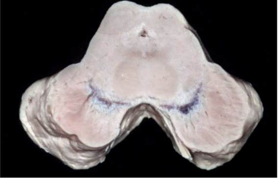 <ul><li><p>Level of the superior colliculus</p></li><li><p>Level of the inferior colliculus</p></li></ul><p></p>