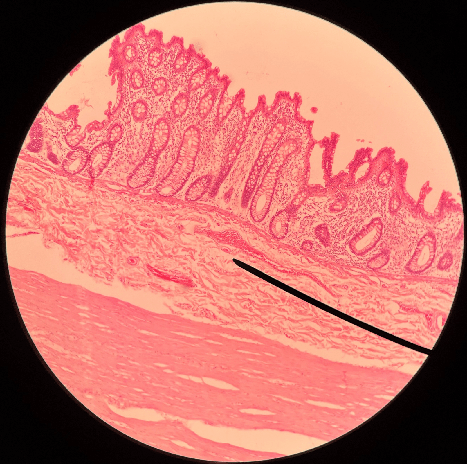• Slide histology of the large intestine.

• The second-deepest layer of the large intestine.

• Superficial to the mucosa.

• Deep to the muscularis.
