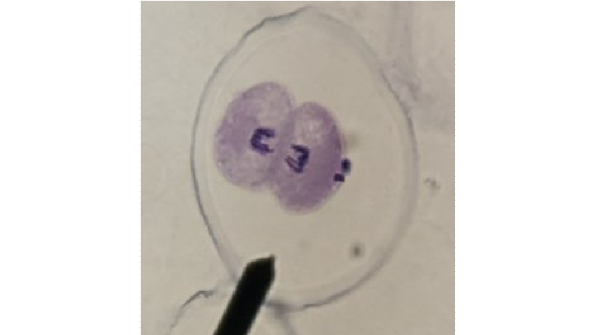 <p>What stage is the cell in?</p>