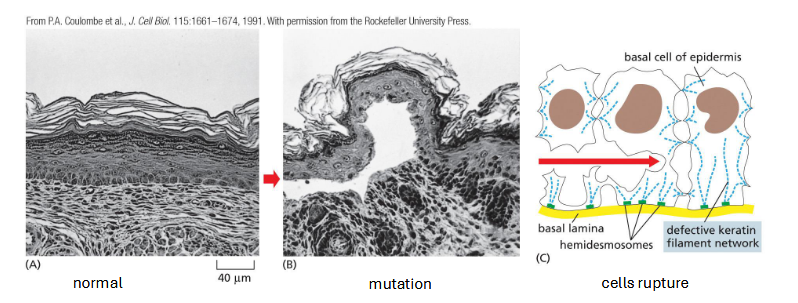<p>skin, hair, nails, claws, scales, horns</p><p>found in epithelial cells</p><p>provide mechanical strength</p><p>many different types</p><p>mutation: rare genetic disease (epidermolysis bullosa simplex) disrupts keratin filament formation</p>