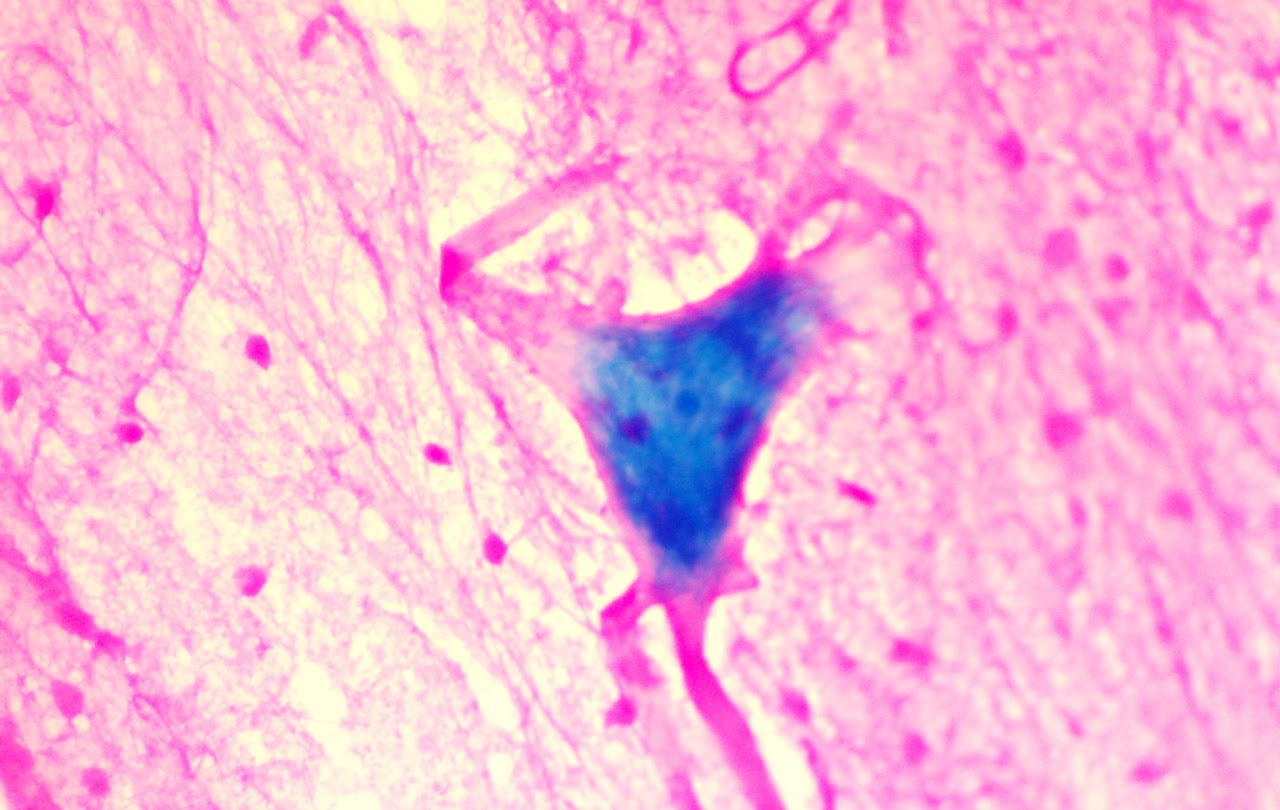 <p><span>Nerve tissue contains neurons and neuroglia and can be found in the brain, spinal cord, and all nerves of the body</span></p>