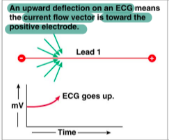 <p>if the electrical activity of the heart is moving towards the positive electrode </p>