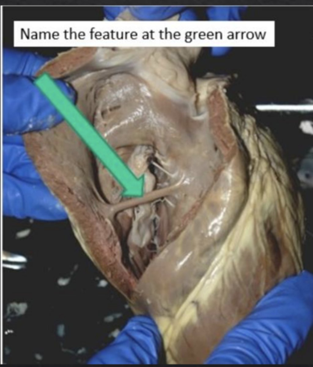 <p>What is the name of the feature at the green arrow?</p>
