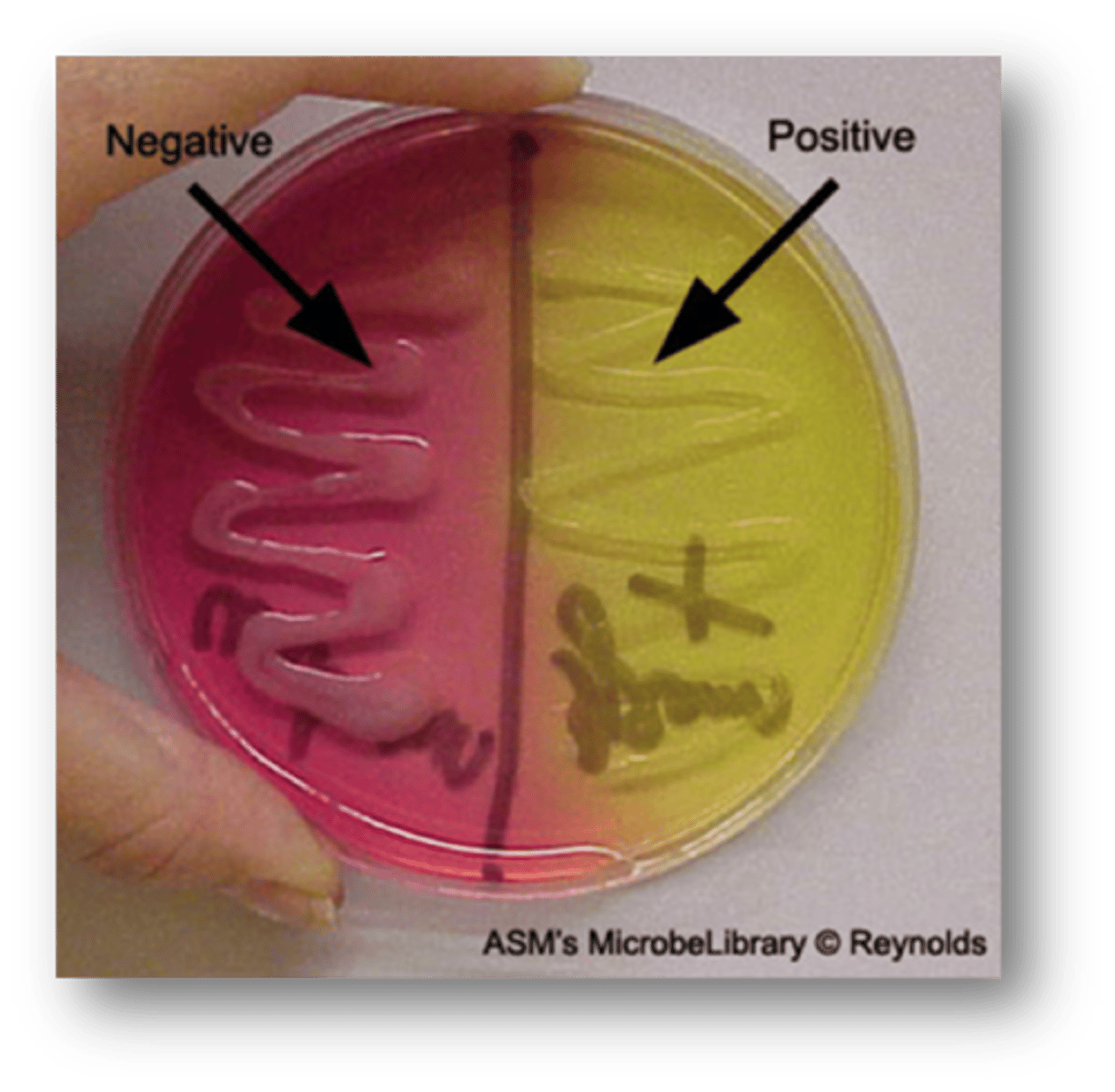 <p>Used for isolation and differentiation of Staphylococcus aureus (yellow) from other Staphylococcus species</p>