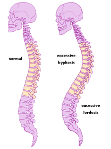 ventral curvature
feature of humans and bipedal close relatives 
