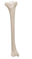 <p>The lower leg. Makes up the knee joint, and medial to the body</p>