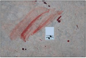 <p>an altered bloodstain pattern resulting from an object moving through a wet bloodstain</p>