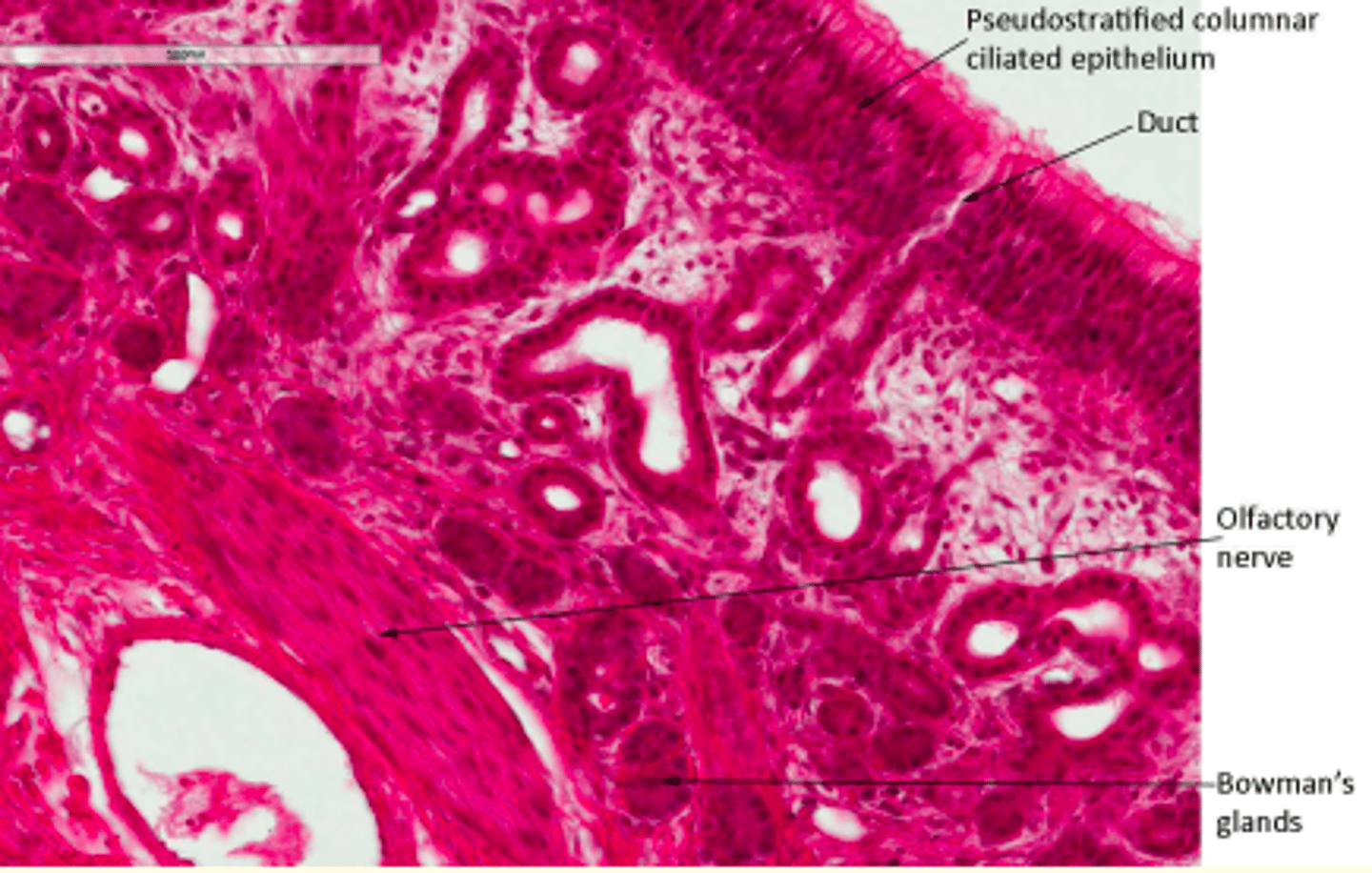 <p>Ciliated olfactory receptor cells (olfactory epithelium)</p>