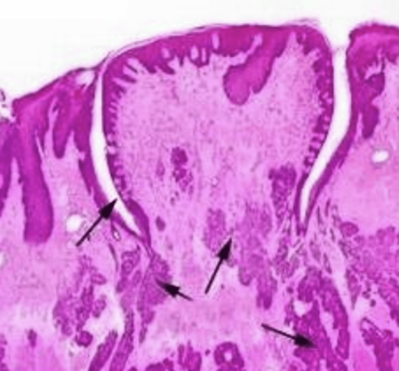 <p>what type of lingual papillae? why?</p>