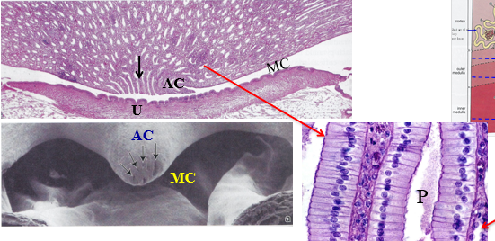 <p>MC </p>