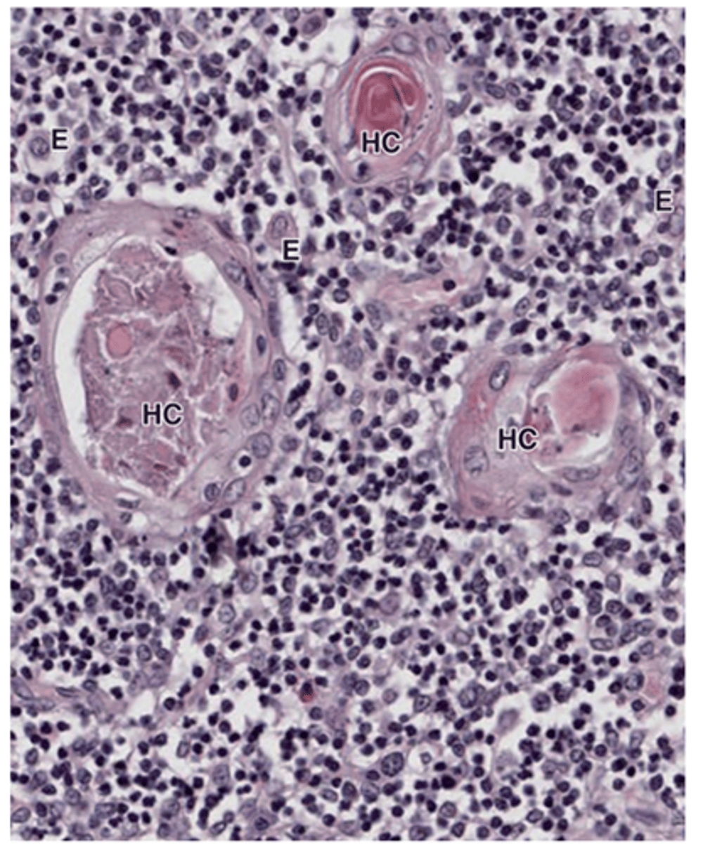 <p>What are the functions of Hassall’s corpuscles?</p>