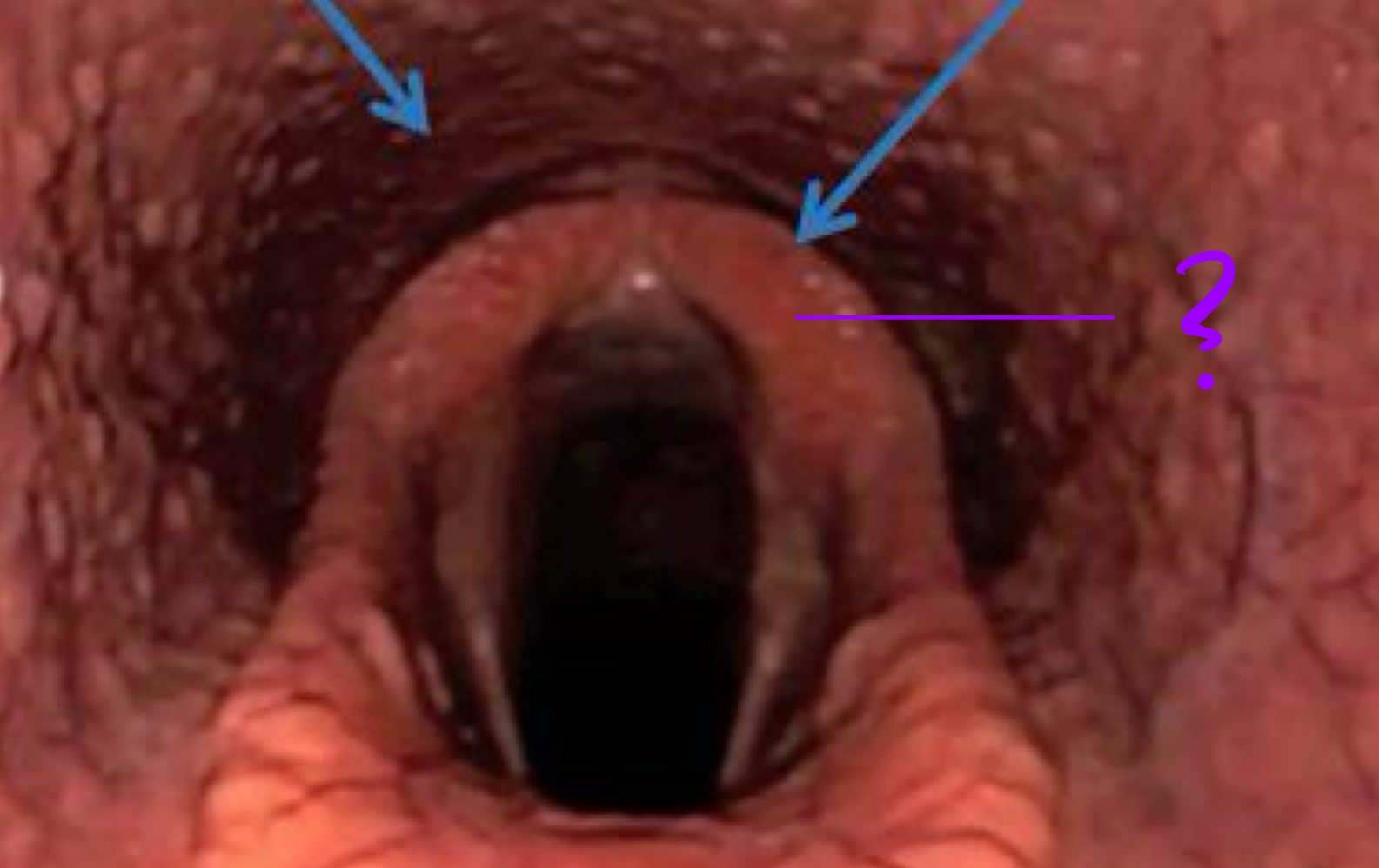 <p>What is the structure in the oral cavity of the equine</p>